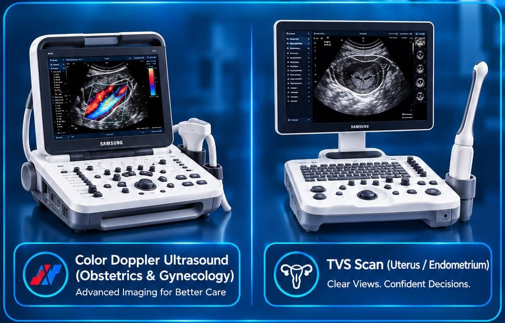 Ultrasound systems for color Doppler and TVS imaging