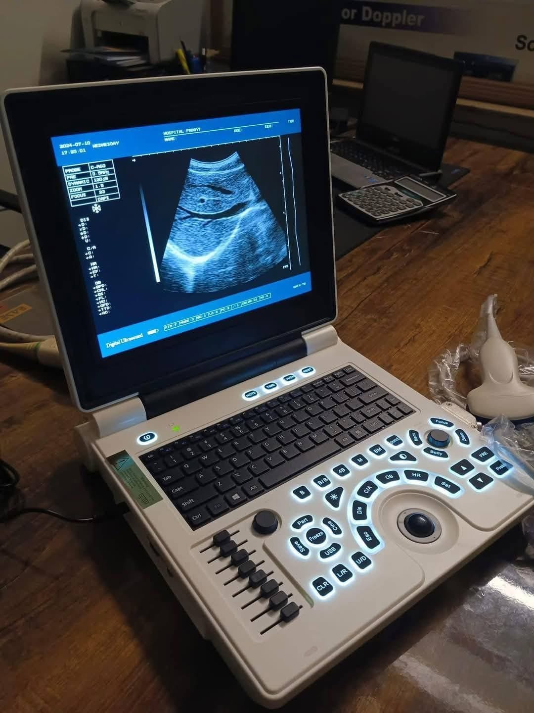 Portable ultrasound machine supplied by Abdullah Surgical and Traders