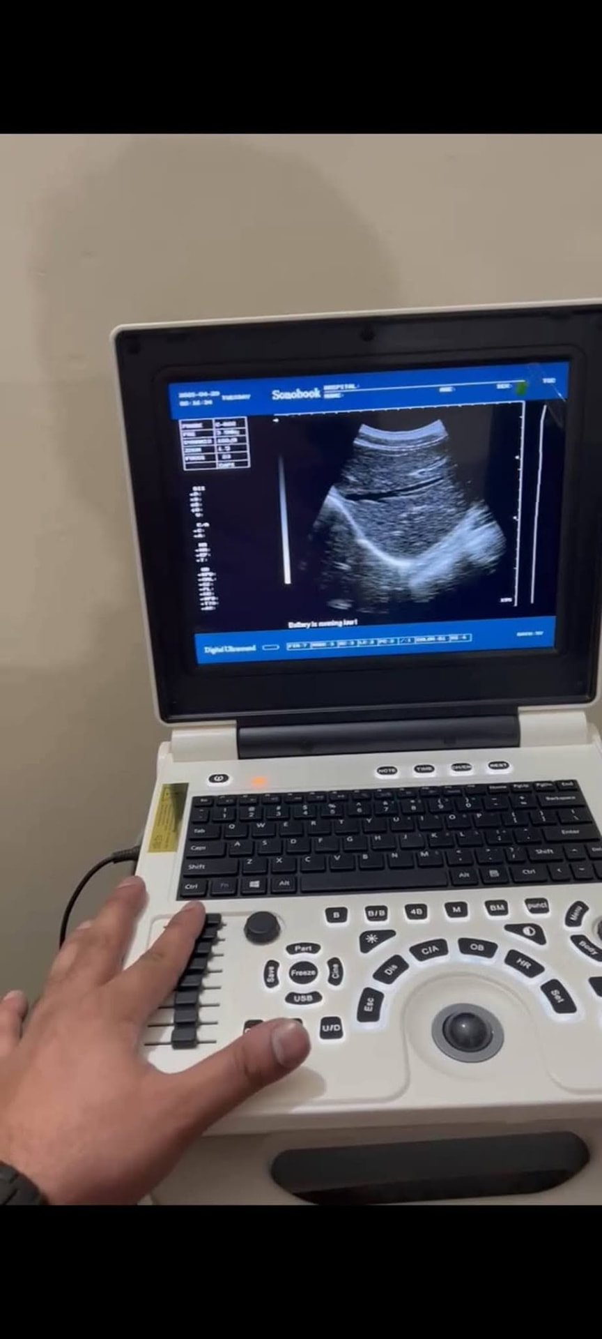 Ultrasound scanner in use during an examination